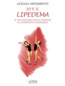 IO E IL LIPEDEMA - Il mio percorso dalla diagnosi all'intervento chirurgico