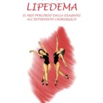 IO E IL LIPEDEMA - Il mio percorso dalla diagnosi all'intervento chirurgico